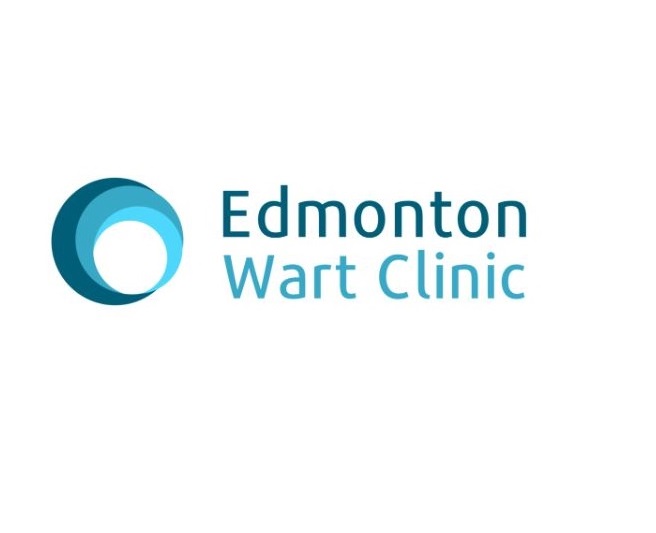 Edmonton Wart Clinic